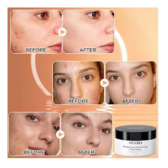 Deep Pore Clay Mask, Blackhead Remover Mask w/ Amazonian White Clay 7oz (200g) - Picture 7 of 10